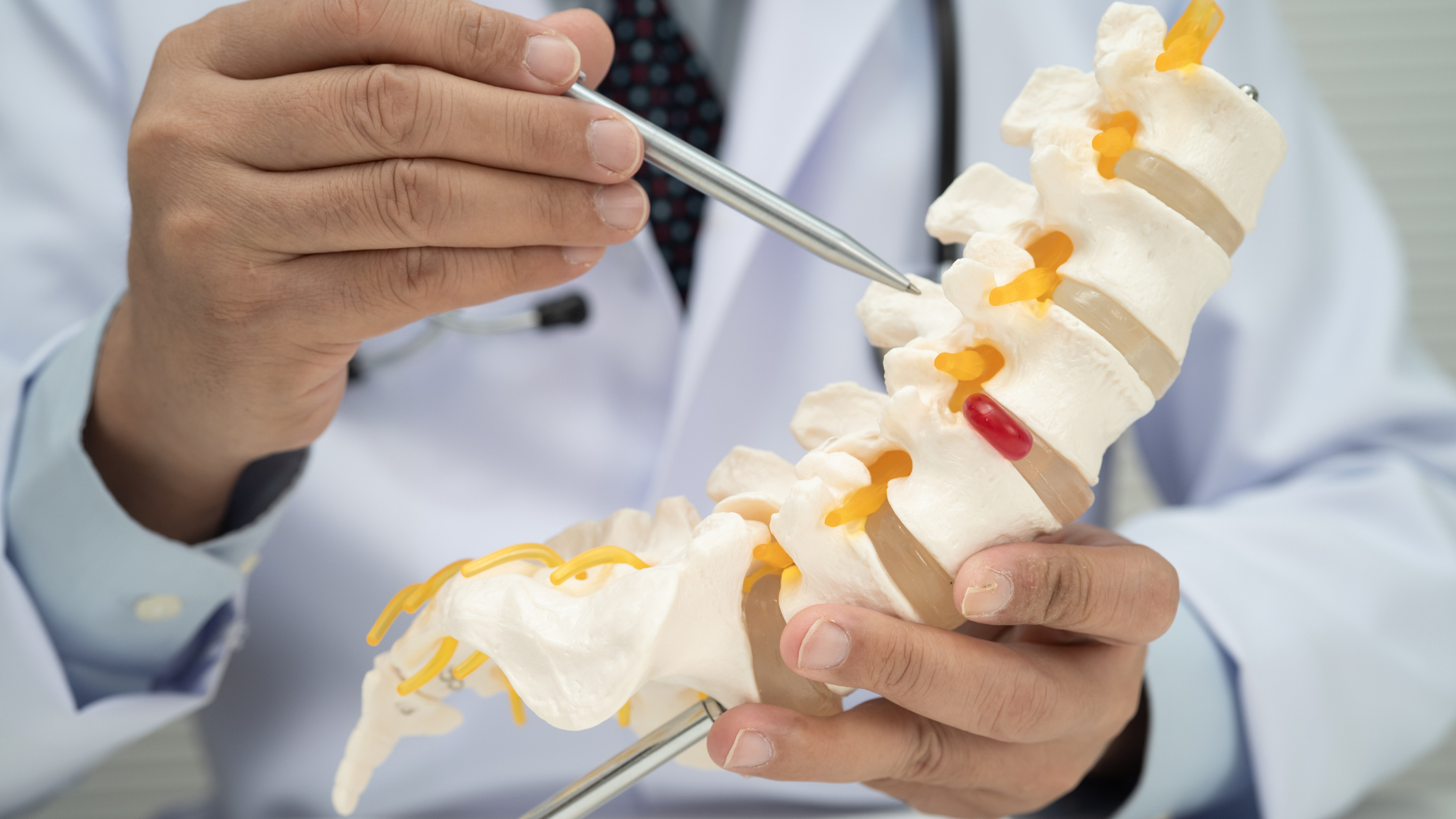 spinal stenosis